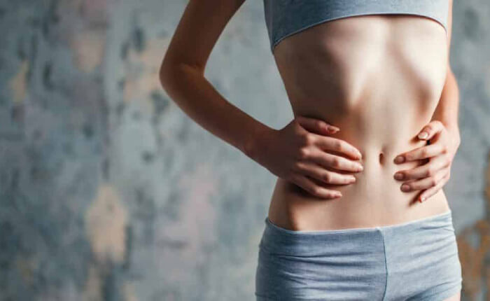 بی اشتهایی عصبی