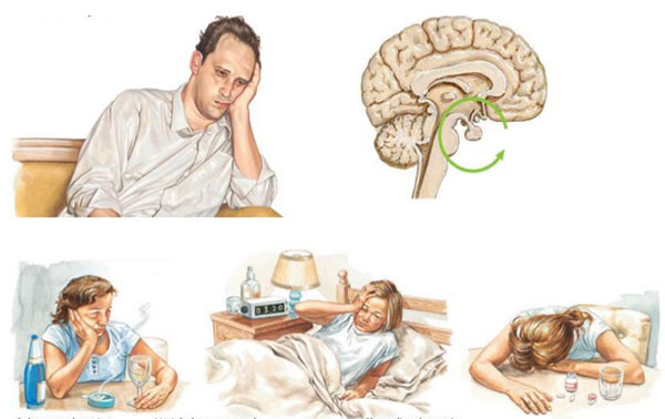 اختلال مانیا و علائم آن