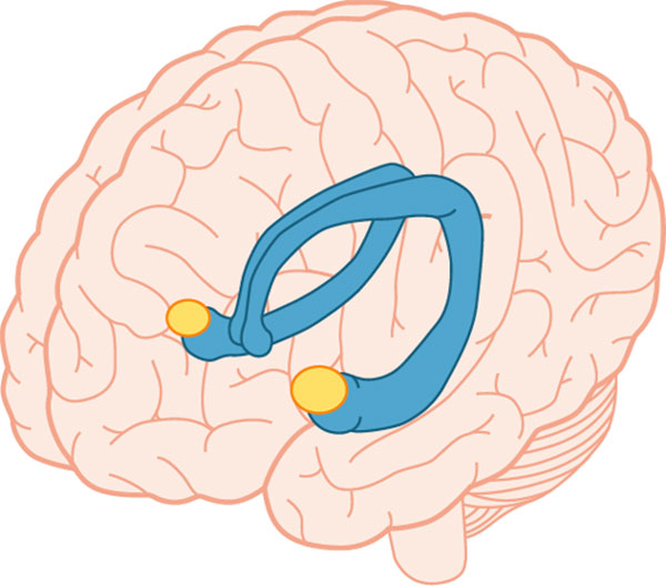 آمیگدال مغز