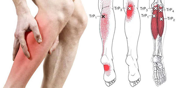 سندرم پای بی قرار چیست؟