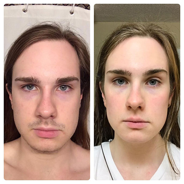 درمان افراد ترانس درمان افراد ترانس