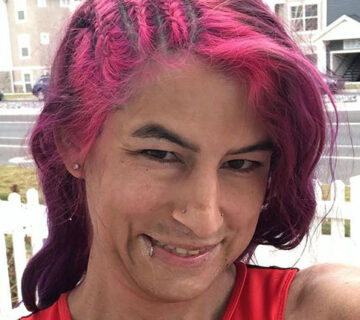 درمان افراد ترانس و راهکارهایی که وجود دارد