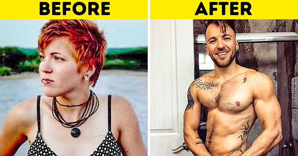 درمان افراد ترانس درمان افراد ترانس