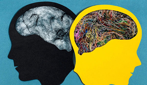 اختلال دوقطبی اختلال دوقطبی