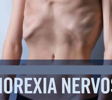 علائم و درمان آنورکسیا یا بی اشتهایی عصبی
