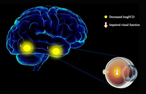 تصویربرداری رزونانس مغناطیسی کاربردی (fMRI)
