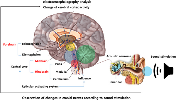 تحریک صوتی چیست؟ تحریک صوتی چیست؟