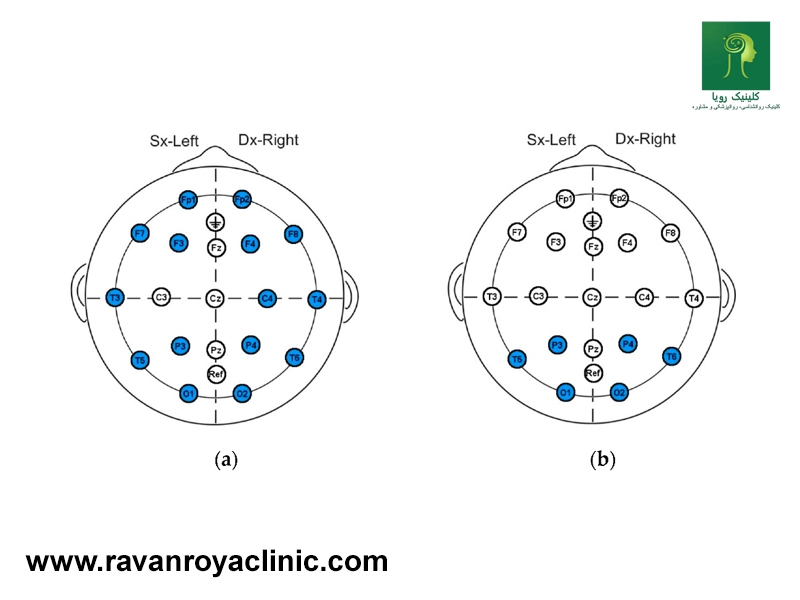 واکنش قشرهای مختلف مغز به EEG