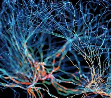 عوامل مؤثر روی هزینه نقشه مغزی