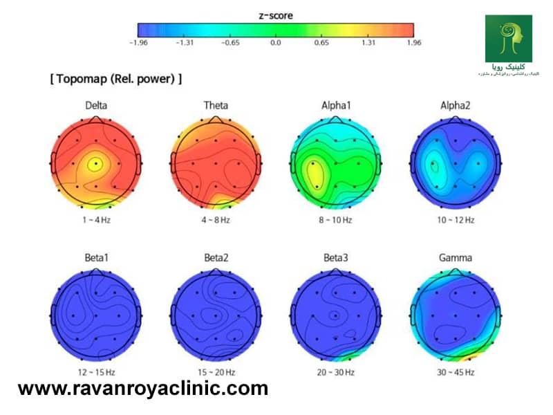 استفاده از نقشه مغزی برای شناخت بهتر عملکرد مغز