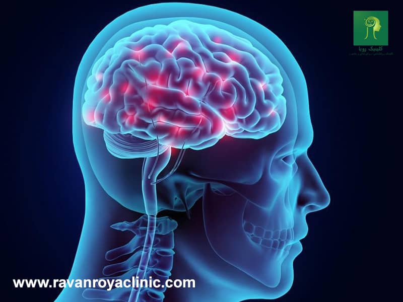 تشخیص بیش فعالی