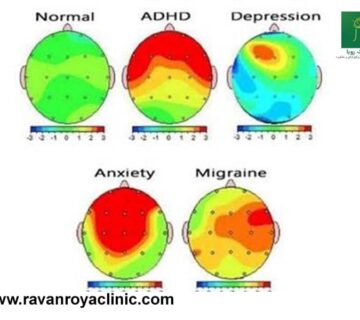 راهنمای تفسیر نقشه مغزی