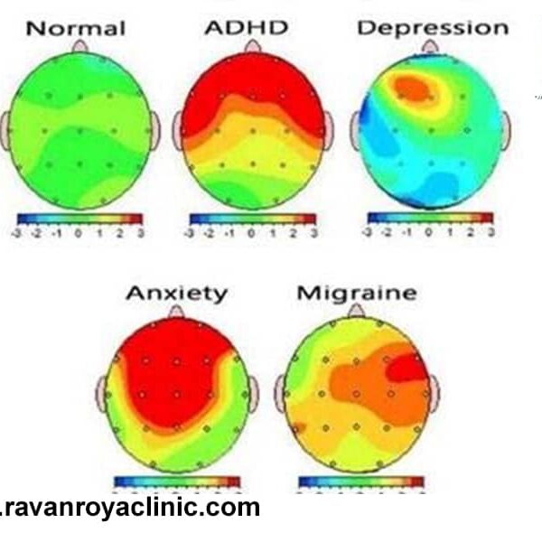 راهنمای تفسیر نقشه مغزی راهنمای تفسیر نقشه مغزی