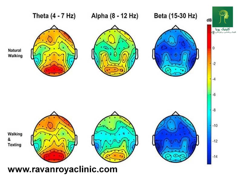 نمودار آلفا، بتا و تتا و ارتباط آنها با حالت های ذهنی مختلف